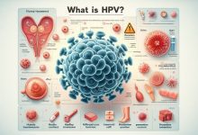 hpv چیست و راه های انتقال آن کدام اند