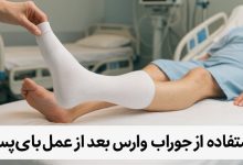 استفاده از جوراب واریس بعد از عمل بای‌ پس