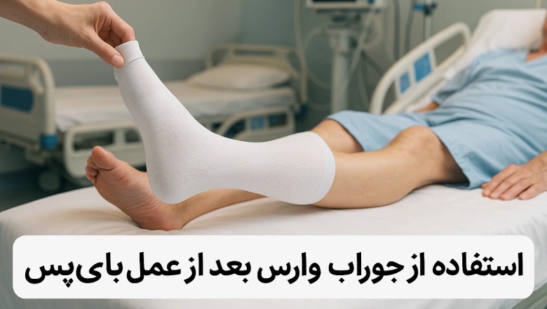 استفاده از جوراب واریس بعد از عمل بای‌ پس