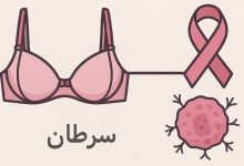 بستن سوتین باعث سرطان میشود
