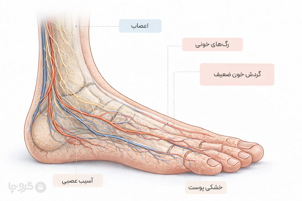 علل حساس بودن پای افراد دیابتی