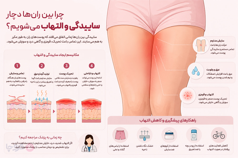 ۴ علت اصلی عرقسوز شدن رانها و راهکارهای جلوگیری از آن