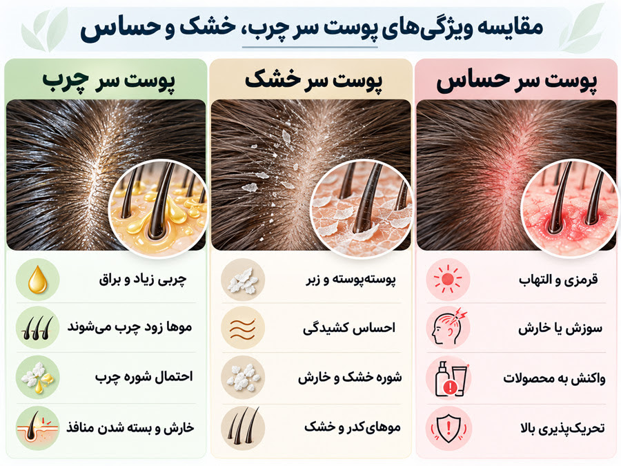 هنگام انتخاب بهترین شامپو برای ریزش مو چه معیارهایی مهم هستند؟
